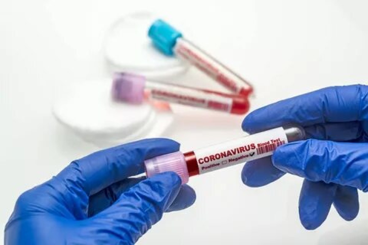 Компания VimaVita предлагает свою помощь заболевшим COVID-19 Компания VimaVita предлагает свою помощь заболевшим COVID-19